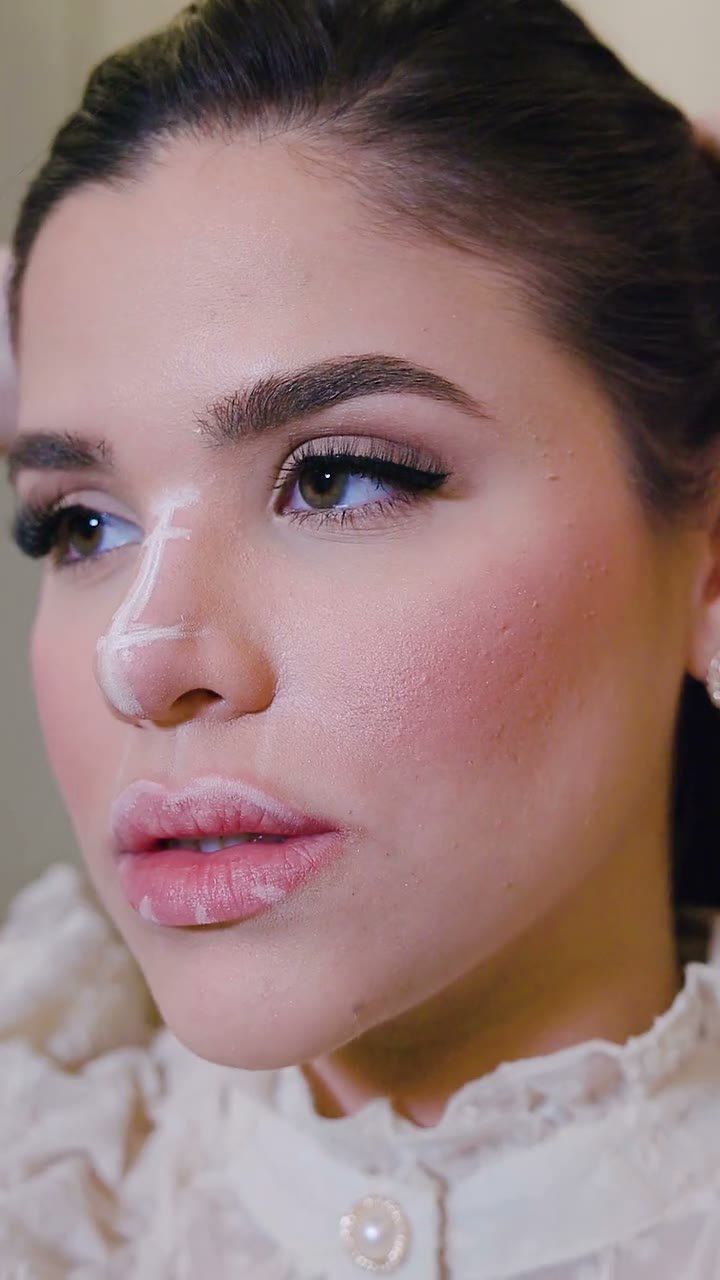 Armonización facial